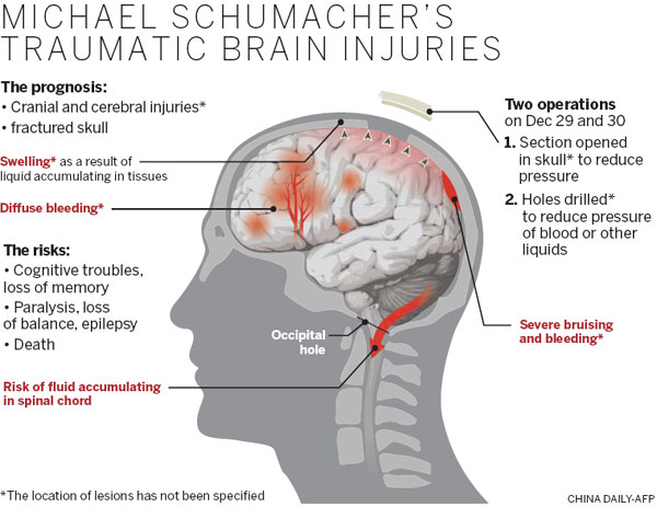 Schumacher out of coma, leaves French hospital